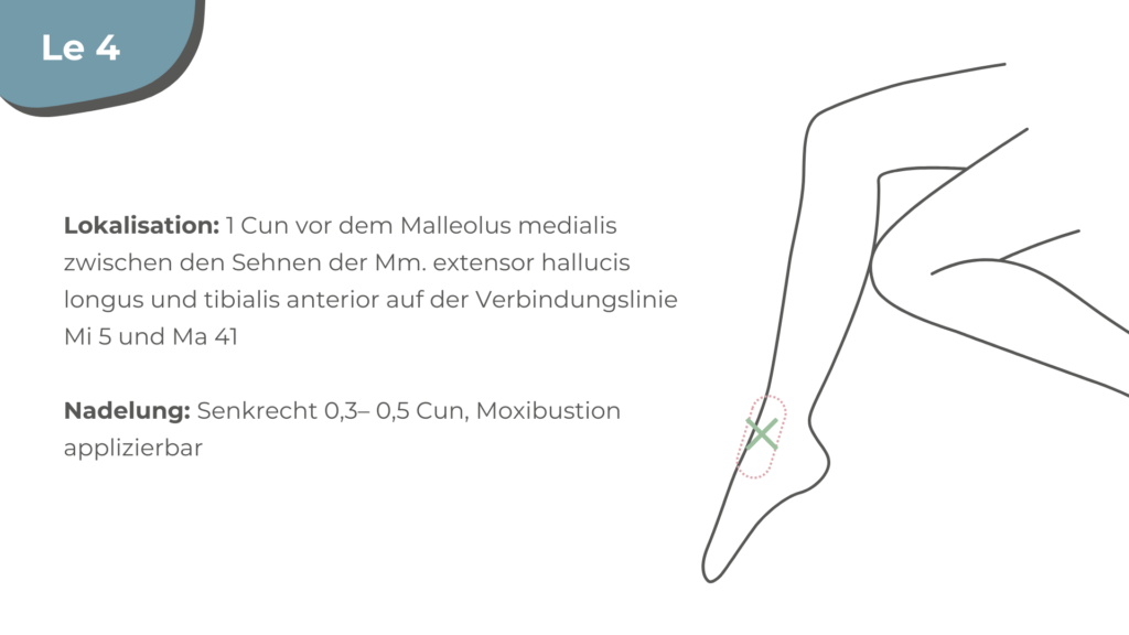 Akupunktur Geburtsvorbereitung in der Nähe Schwangerschaft